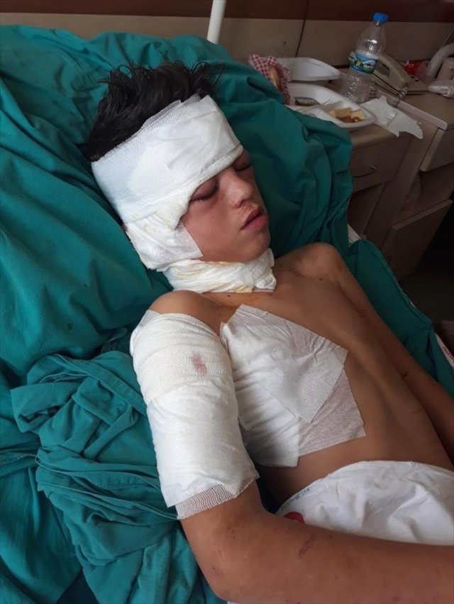 Muğla’da Köpeklerin Saldırdığı Çocuk Yaralandı