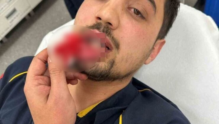 Bursa’da ambulans sürücüsü darp edildi