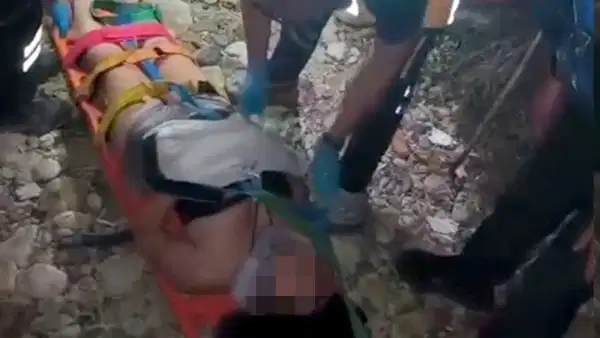 3 metre yükseklikten kayalıklara düşen genç kız yaralandı